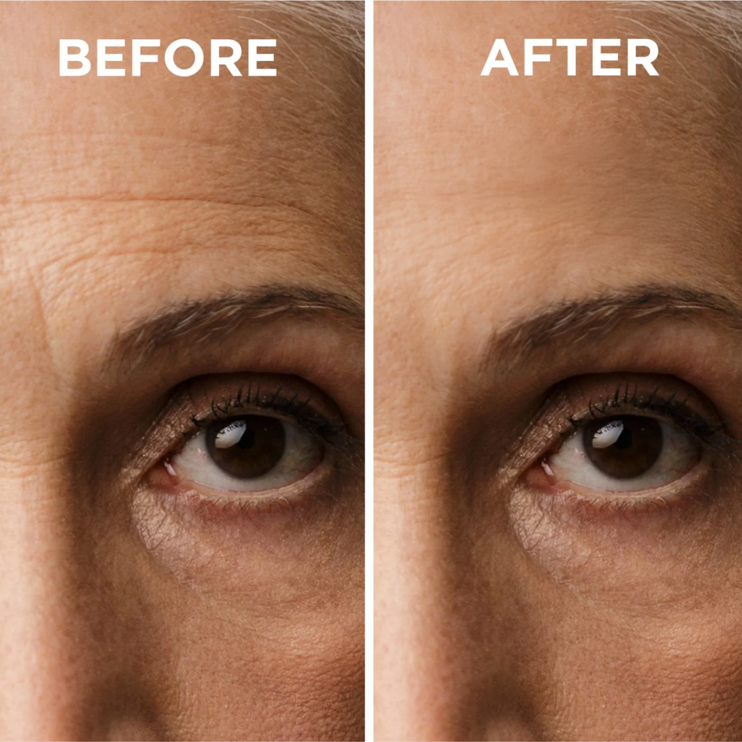 Anti Acne + Wrinkle Silicone Sheets